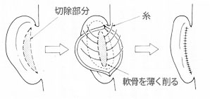 千葉たち耳なおす