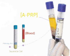 千葉PRP幹細胞治療