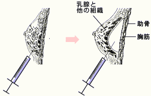 バスト大きくなる