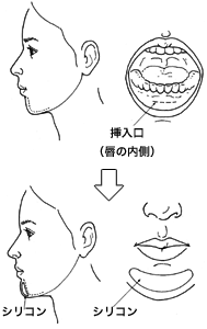 千葉アゴを出す