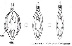 千葉小陰唇サンライズ美容外科