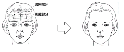 千葉額プレート